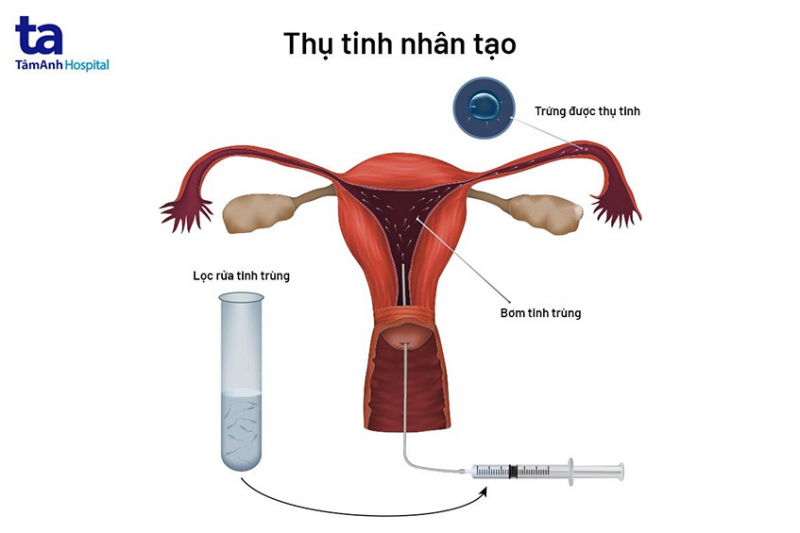 Bệnh viện Đa khoa Tâm Anh