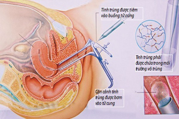 Bệnh viện Phụ sản Trung ương