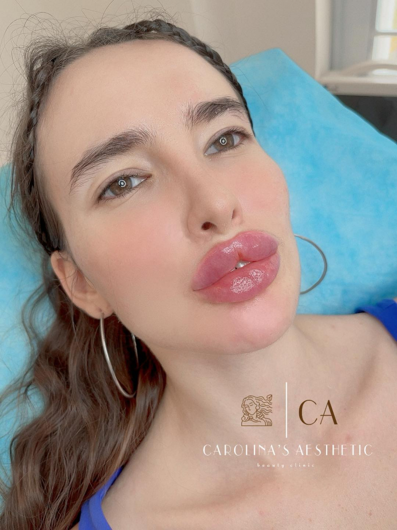 Carolina's Aesthetic - Thẩm Mỹ Filler Nha Trang